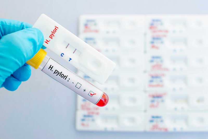 Đau dạ dày là gì? Cách phòng ngừa và điều trị tận gốc? 24 xet-nghiem-h-pylori-da-day